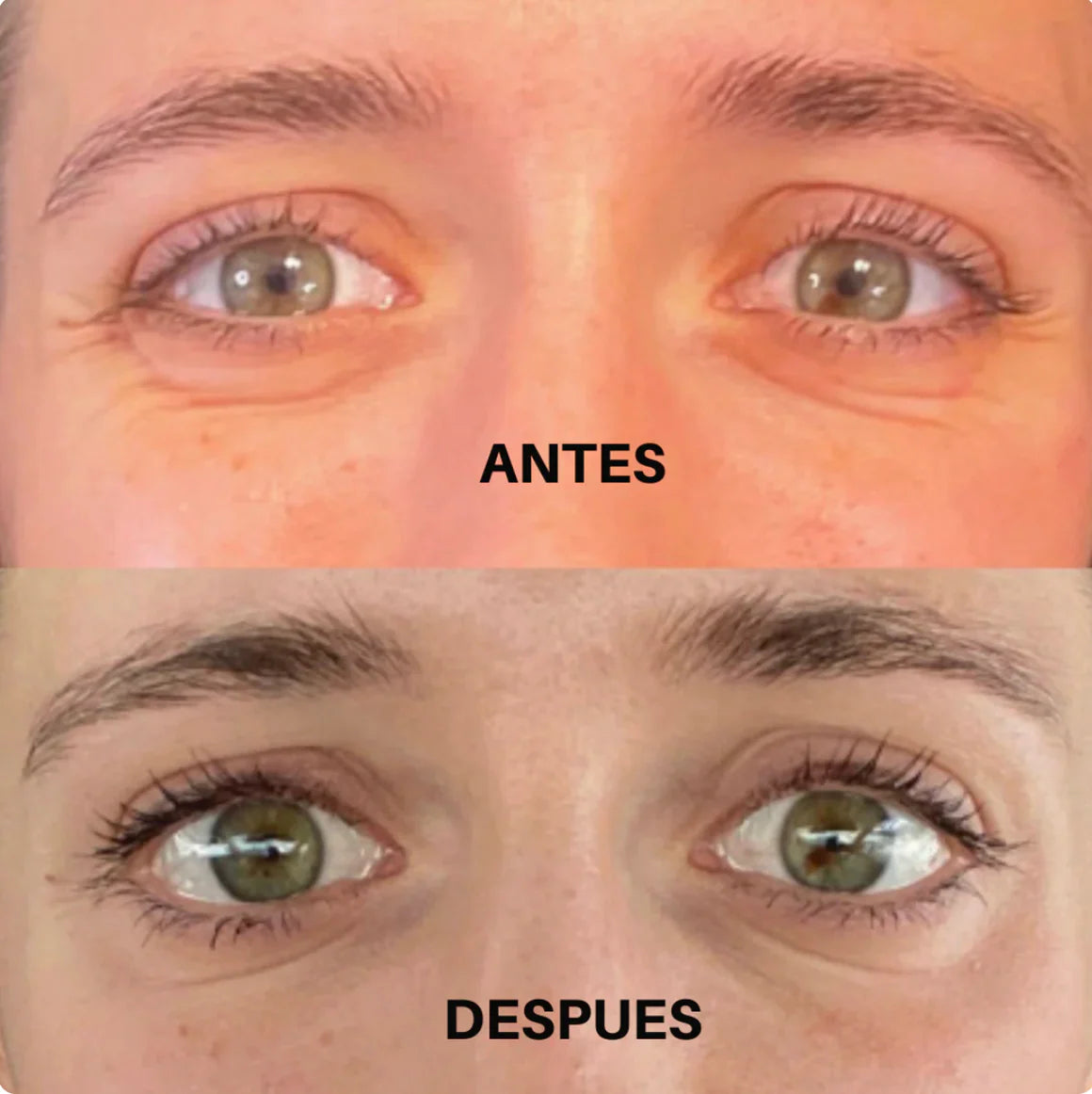 Astaxantina – El “Botox Natural” 2X1: Rejuvenece en 30 Días o Te Devolvemos Tu Dinero 🍃